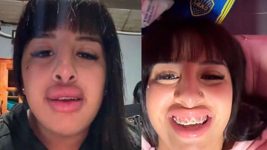 A la Coqueta se le escapó un detalle más del escándalo viral de la inyección de ácido hialurónico que le puso una lashista y explotó todo