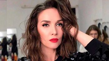 Natalia Oreiro contó que padece una extraña enfermedad neurológica