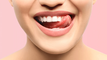 Dientes más blancos y saludables: el enjuague casero que previene enfermedades y elimina la placa