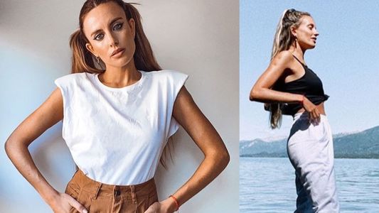 Melina Lezcano confesó qué cirugía se arrepintió de haberse hecho