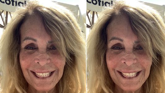 La primera imagen de Pata Villanueva tras el grave accidente