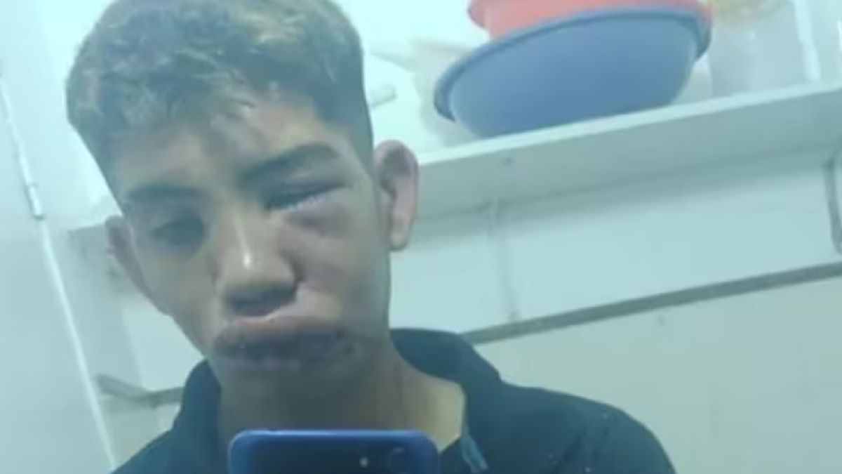 As&iacute; qued&oacute; el joven tras sufrir una brutal golpiza.