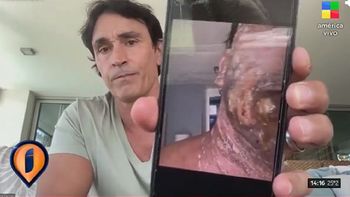 Sebastián Estevanez reapareció a siete meses del accidente: Sentía que me iba a morir