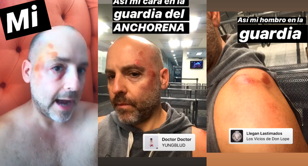 José María Muscari se accidentó en la Avenida Córdoba cuando conducía un monopatín eléctrico