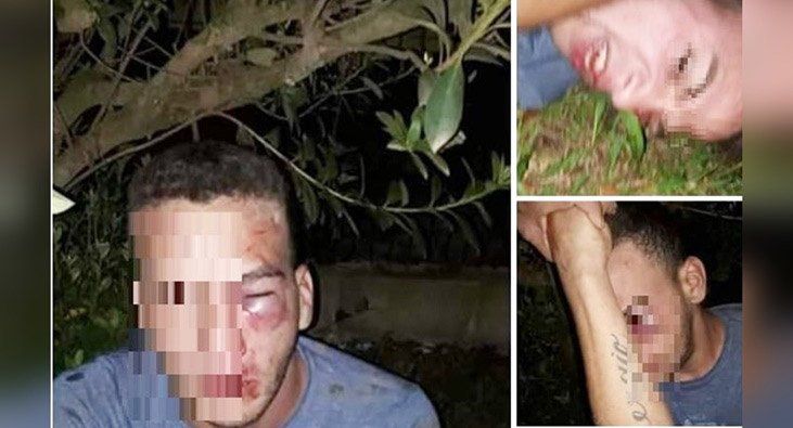 Así quedó el hombre linchado por ser acusado de grooming. (Foto: fuente Misionesonline)