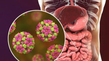 Norovirus: limpieza urgente en boliches, hoteles y colectivos por contagio de 1.200 chicos en Bariloche