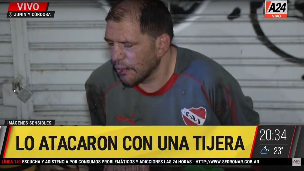 El detenido con golpes en su cara tras haber peleado con su víctima (Foto: Captura).
