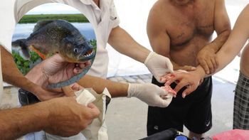 Polémica por un ataque de palometas en Santa Fe: ¿qué hacer frente a una mordedura y como prevenir el ataque?