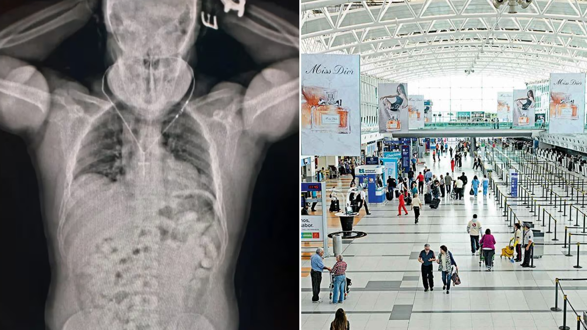 Detuvieron un hombre que intentaba viajar a España con 84 cápsulas de cocaína en su estómago. (Foto: Télam/AFIP)