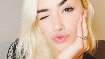 El gesto de Lali Espósito que sorprendió a sus fans