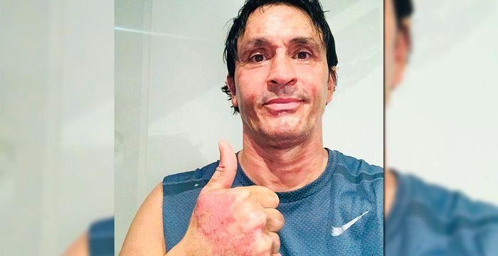 Sebastián Estevanez volvió a mostrarse tras el accidente doméstico y contó cómo se encuentra