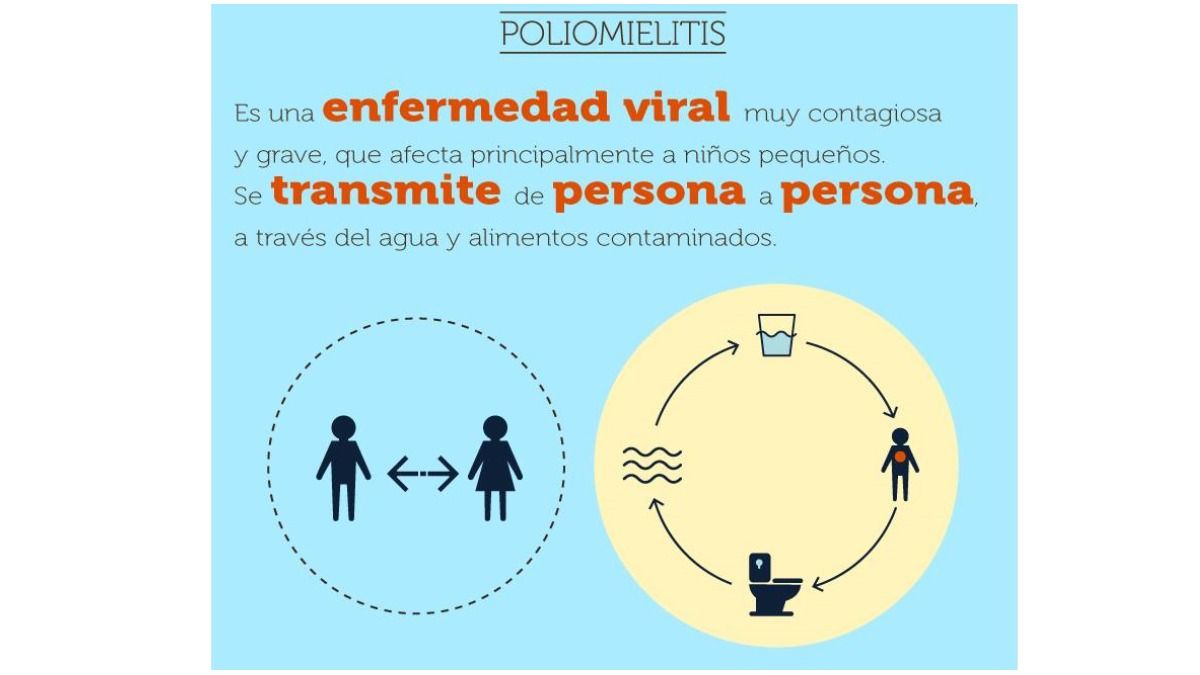 La poliomielitis está causada por el poliovirus, un virus perteneciente al género enterovirus.