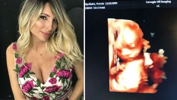 Vicky Xipolitakis mostró la ecografía 4D de su hijo