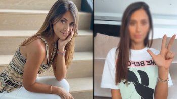 antonela roccuzzo publico un video en las redes y genero un escandalo: ¿se opero la cara?