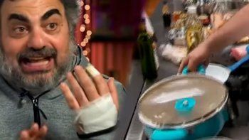 El accidente de Roberto Moldasvky en Masterchef Celebrity: ¿Qué más me puede pasar?