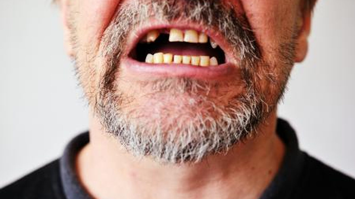 Puede estar vinculado a crisis personales o a momentos de baja autoestima. Foto: Sueño/Internet. Puede estar vinculado a crisis personales o a momentos de baja autoestima. Foto: Sueño/Internet.