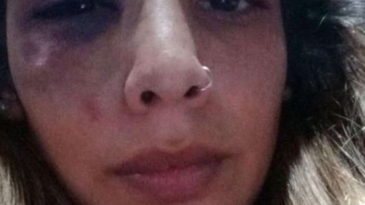 Una joven fue desfigurada por su pareja y vivió un calvario: Agarró un destornillador y quiso apuñalarme
