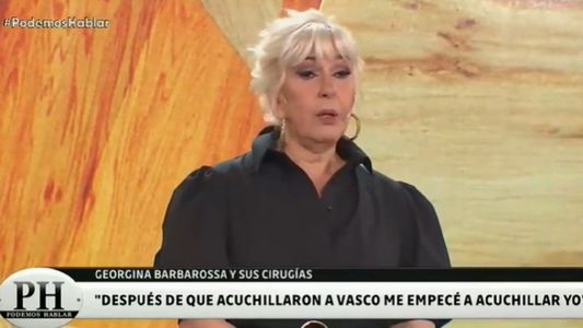 Georgina Barbarossa y su adicción a las cirugías: Le mentía a mi terapeuta y me iba a operar igual