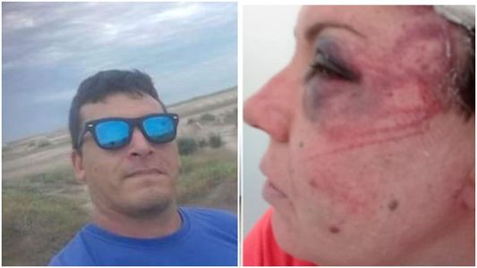 Caso Alejandro Martínez: policías de la Comisaría de San Clemente del Tuyú habían desfigurado a golpes a una mujer en el calabozo