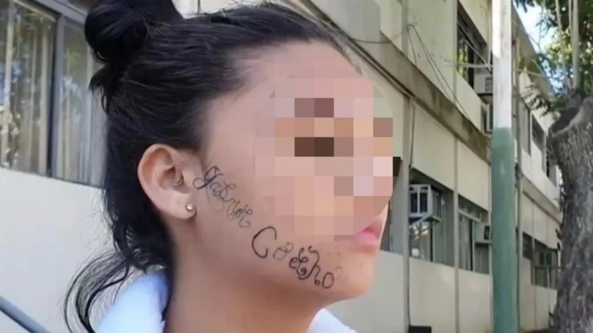 Una joven presentó una denuncia por violencia de género contra su ex pareja por taturarle en la cara su nombre para que sea de su propiedad