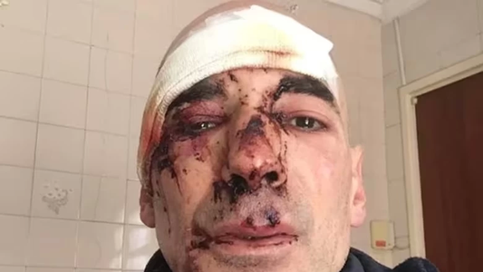 Fueron a matarme: un runner sufrió una feroz golpiza de motociclistas en Mar del Plata