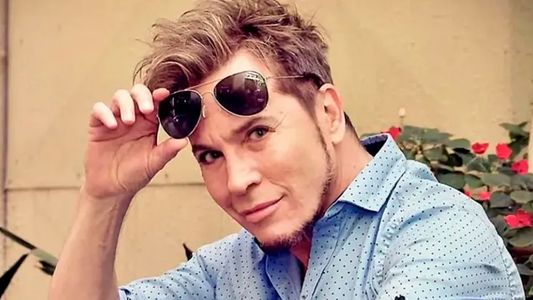 Guido Süller mostró el antes y después de sus cirugías: impactante transformación