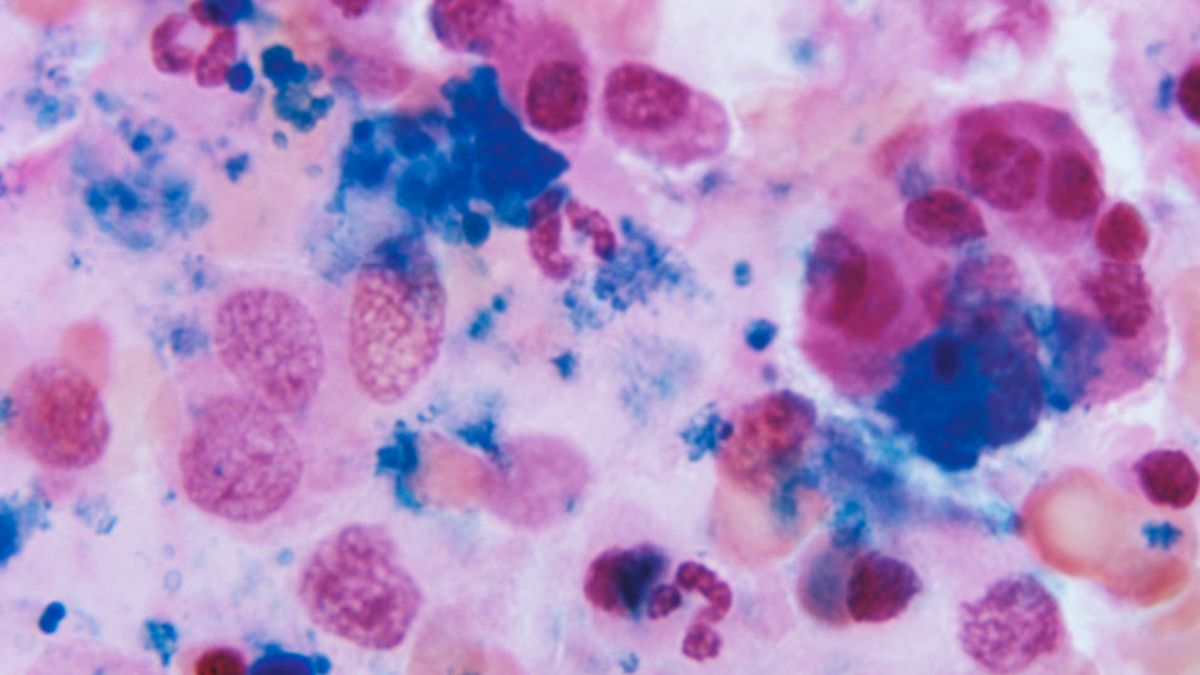 Imagen de microscopio electrónica de la médula ósea. (Foto: Dr. Gordon D. McLaren - CDC)&nbsp;