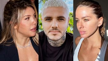 La foto de Wanda Nara con marcas en la piel por Mauro Icardi que saca de quicio a la China Suárez