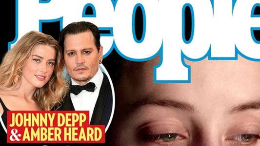 Amber Heard en nuevas fotos que probarían la supuesta agresión de Johnny Depp