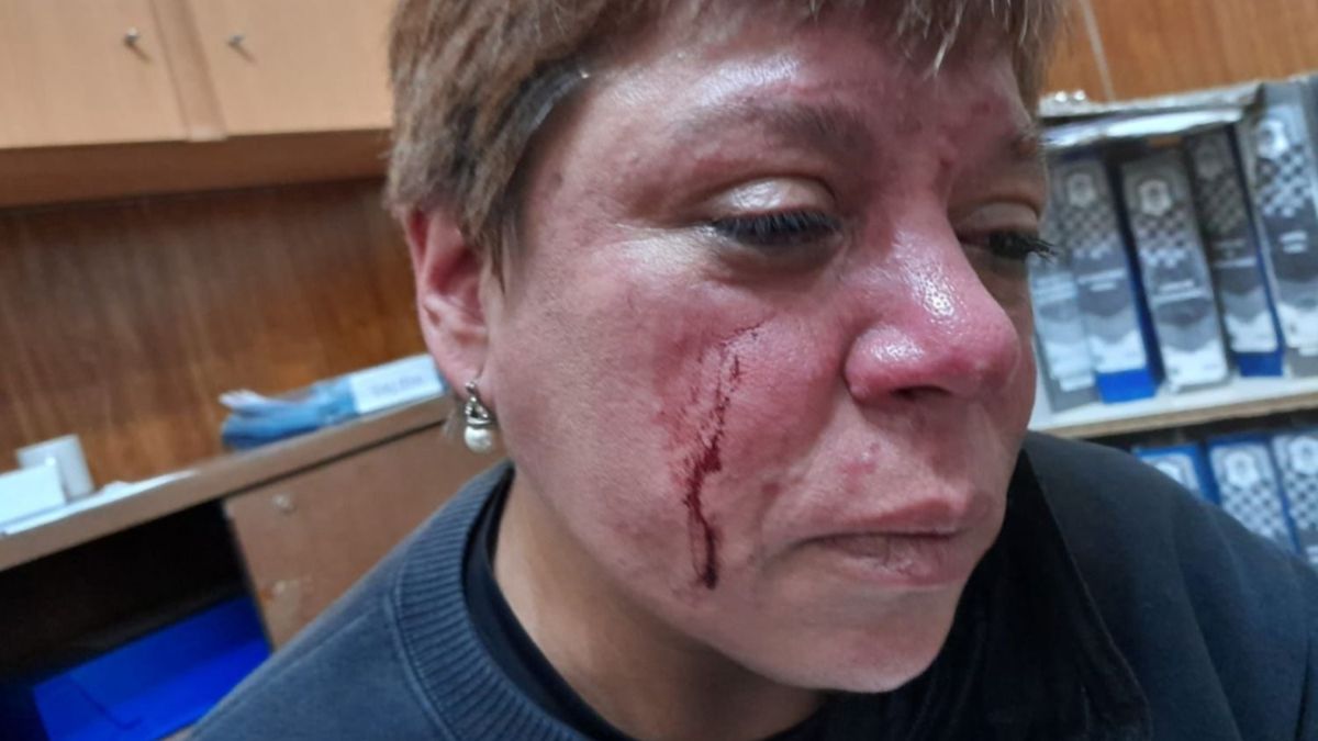 Una inspectora municipal fue agredida en La Plata por los dueños de una hamburguesería