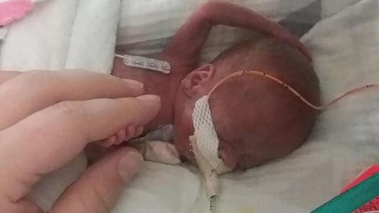 El bebé más prematuro del mundo celebró su primer cumpleaños