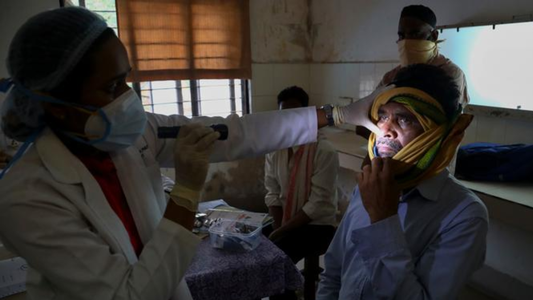 ¿A quien ataca el Hongo Negro y como se relaciona con el Covid-19?