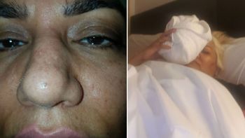 Fuerte golpe en la nariz y reposo para Gladys La Bomba Tucumana