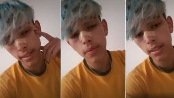 El Chyno Agostini respondió a las críticas por su look: Lo hago porque me gusta a mí, es feo discriminar