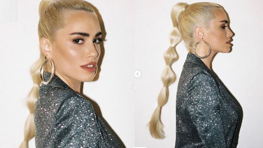 ¿Hay enojo? Lali Espósito habló de Ana Paula Rodríguez