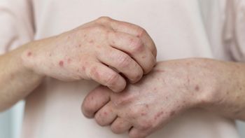 La advertencia sanitaria para quienes vuelven del Mundial 2026 por el riesgo de un virus contagioso