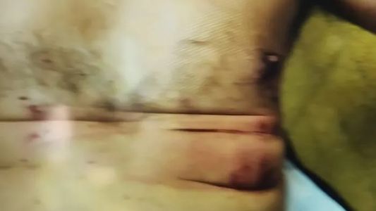 Así son las imágenes del oficial herido por la bomba en la Escuela Superior de Gendarmería