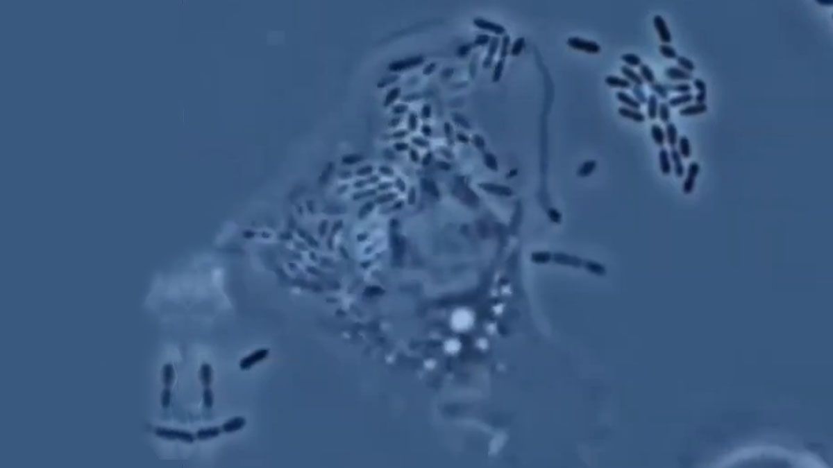 Las bacterias modificadas por ingeniería genética para atacar tumores. (Foto: Captura de TV)