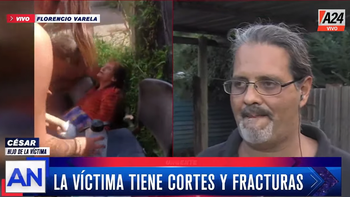 Una mujer fue atacada por cinco perros pitbull mientras caminaba por la calle: Está viva de milagro. (Foto: captura) Una mujer fue atacada por cinco perros pitbull mientras caminaba por la calle: Está viva de milagro. (Foto: captura)