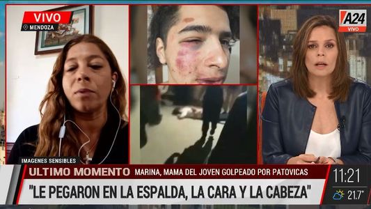 Mendoza: brutal golpiza a un joven de 19 años por patovicas