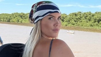 Se supo si Wanda Nara puso en riesgo su enfermedad al hacerse una cirugía estética