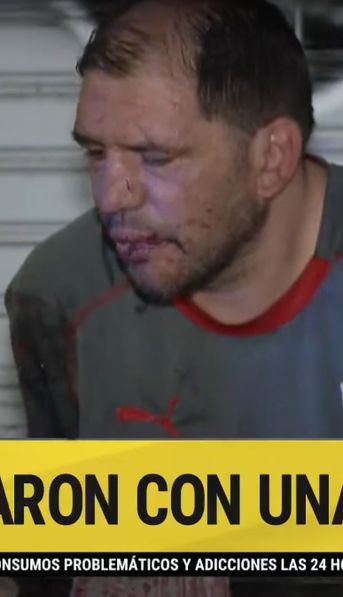 Recoleta: un hombre se resistió a un asalto y lo apuñalaron