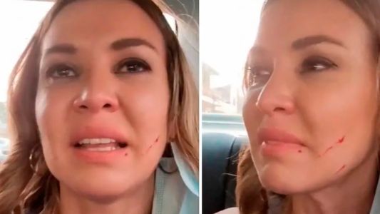 Video: Dallys Ferreira, agredida y lastimada en Paraguay