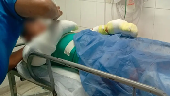 Un adolescente de 16 años resultó gravemente herido tras un accidente doméstico ocurrido en una vivienda en Córdoba. Foto: Diario Perfil/ CEDOC.