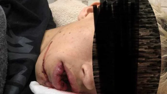 Luján: salvaje golpiza a un joven de 19 años a la salida de un boliche