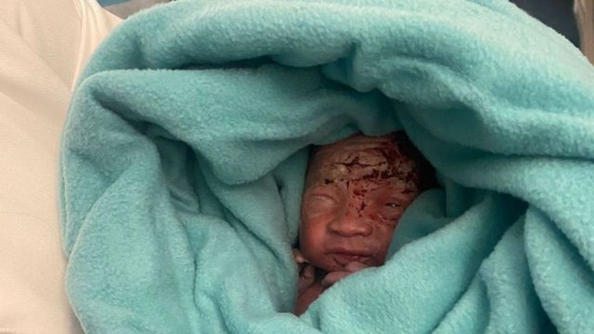 El bebé aún tenía el cordón umbilical