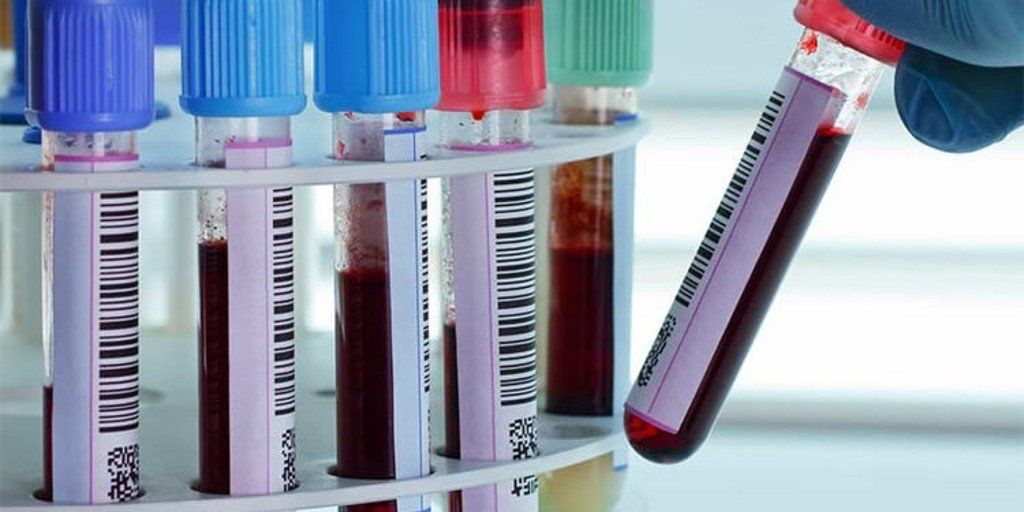 Un estudio reveló cuáles son los tipos de sangre más vulnerables y más resistentes al coronavirus