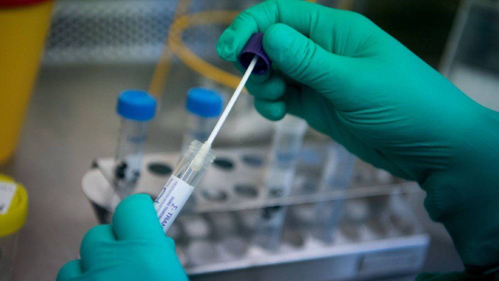 Según un estudio alemán, el COVID-19 se propaga mil veces más en la garganta que el virus del SARS