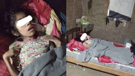 Por la presión pública, trasladaron a un hospital a la nena wichi huérfana que quedó ciega por desnutrición