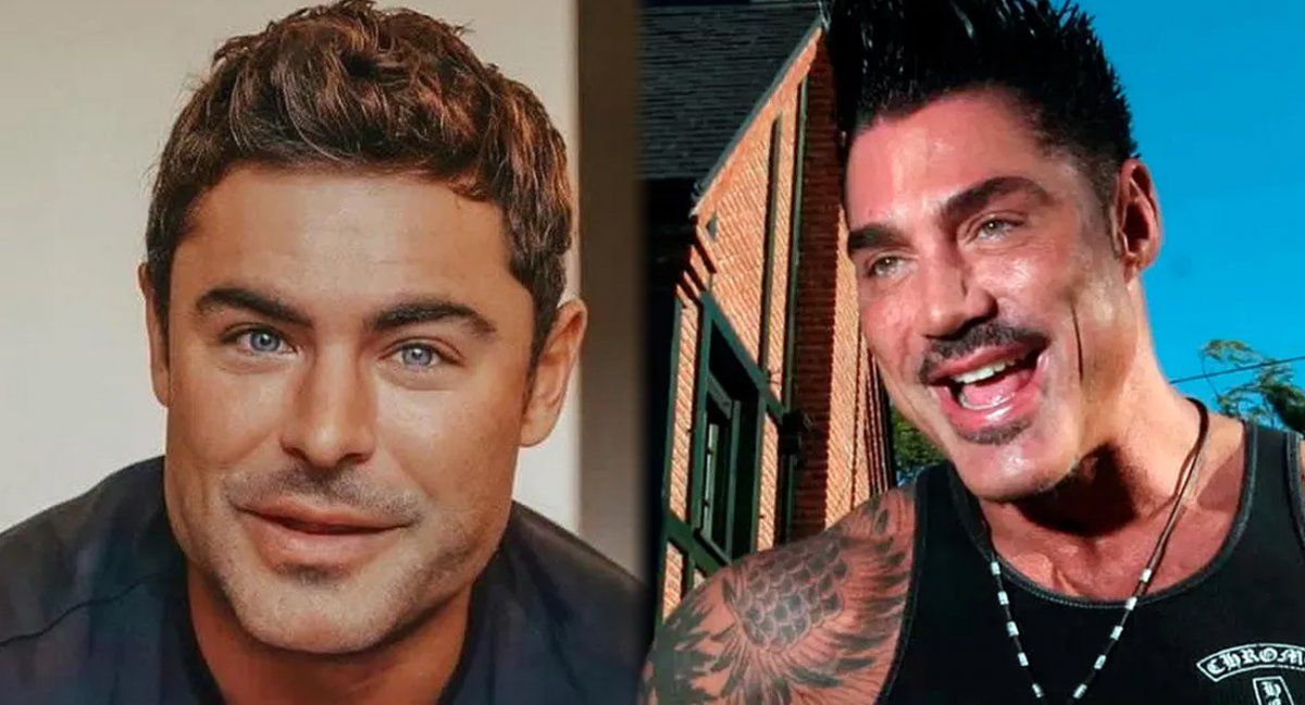 Zac Efron se puso bótox y fue tendencia por su nueva cara
